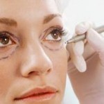 Before plastic surgery, surgeon draws surgical lines along woman's undereye circles